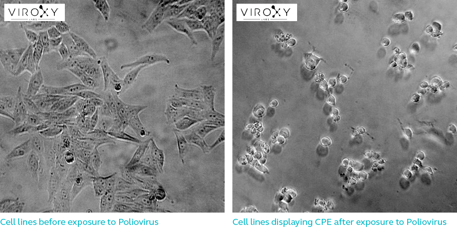 Cell lines before & after exposure to Poliovirus