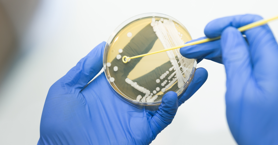 Sterile inoculating loop in contact plate with growth