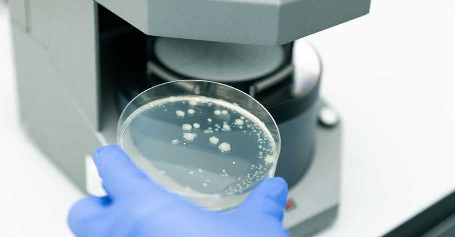 Bioburden testing using plate-count method